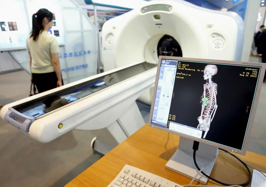 DAMO RADAR: Alibaba's open-source generalist radiology AI screens 146 abdominal findings and challenges the narrow-disease vendor model