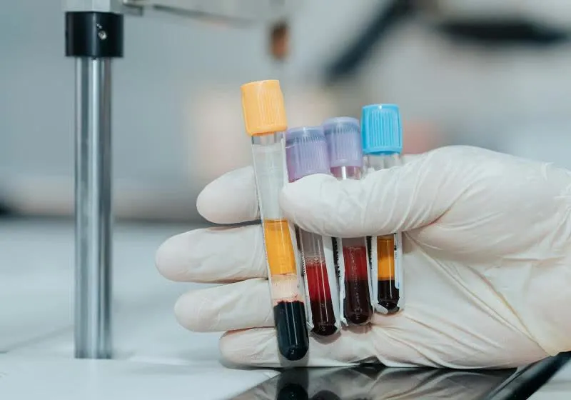 Rentosertib aging trial: AI-designed drug reduces biological age markers, but caveats remain