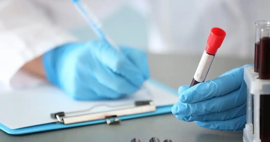 Could AI & a Blood Test Help Spot Lung Cancers Early?