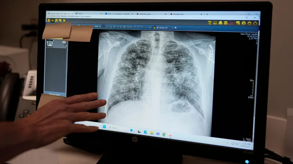 FDA Breakthrough Designations Signal End-to-End Radiology AI Progress, with Cognita and Aidoc Leading the Way