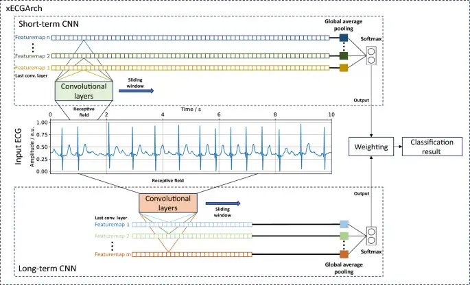 xECGArch: a trustworthy deep learning architecture for interpretable ECG analysis considering short-term and long-term features